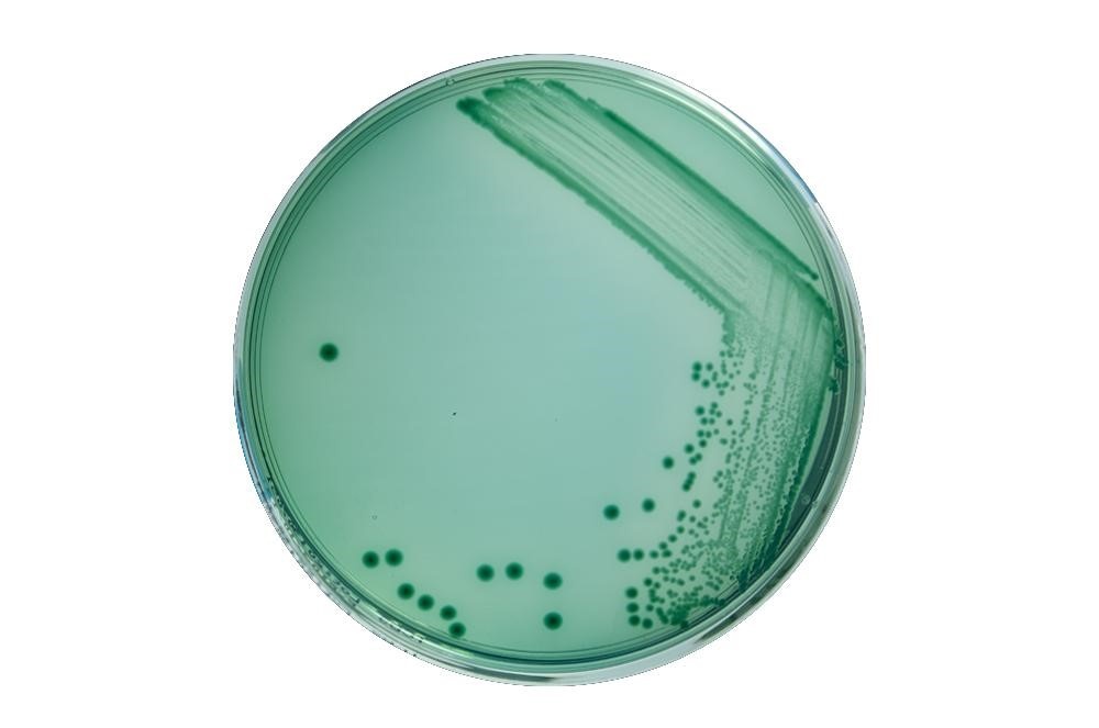 Người nuôi tôm thường nghĩ nhóm vi khuẩn Vibrio là nguyên nhân gây bệnh trên tôm, điều đó đúng - nhưng không phải với tất cả Vibrio, thậm chí chúng còn có lợi.